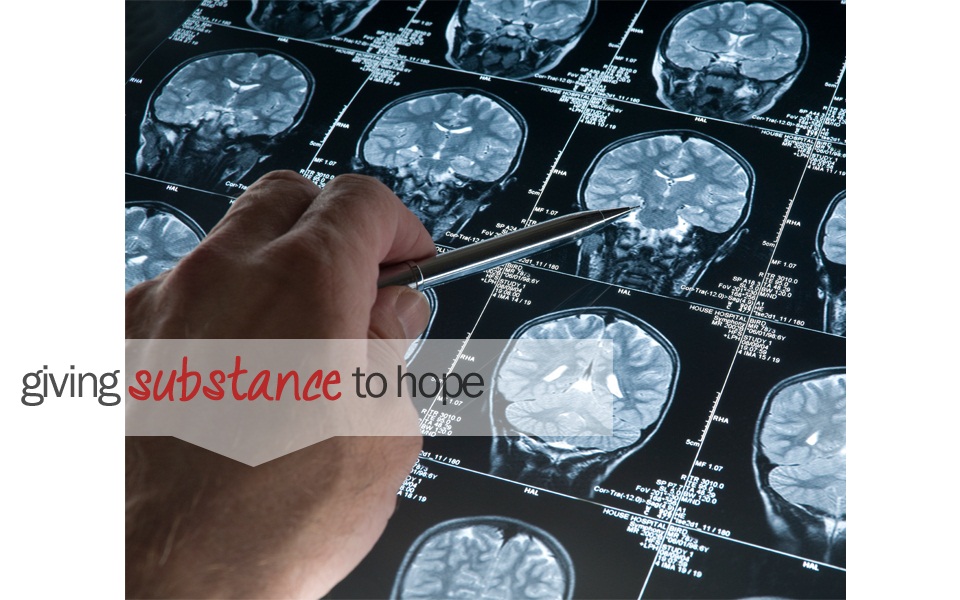 Brain Matters Research