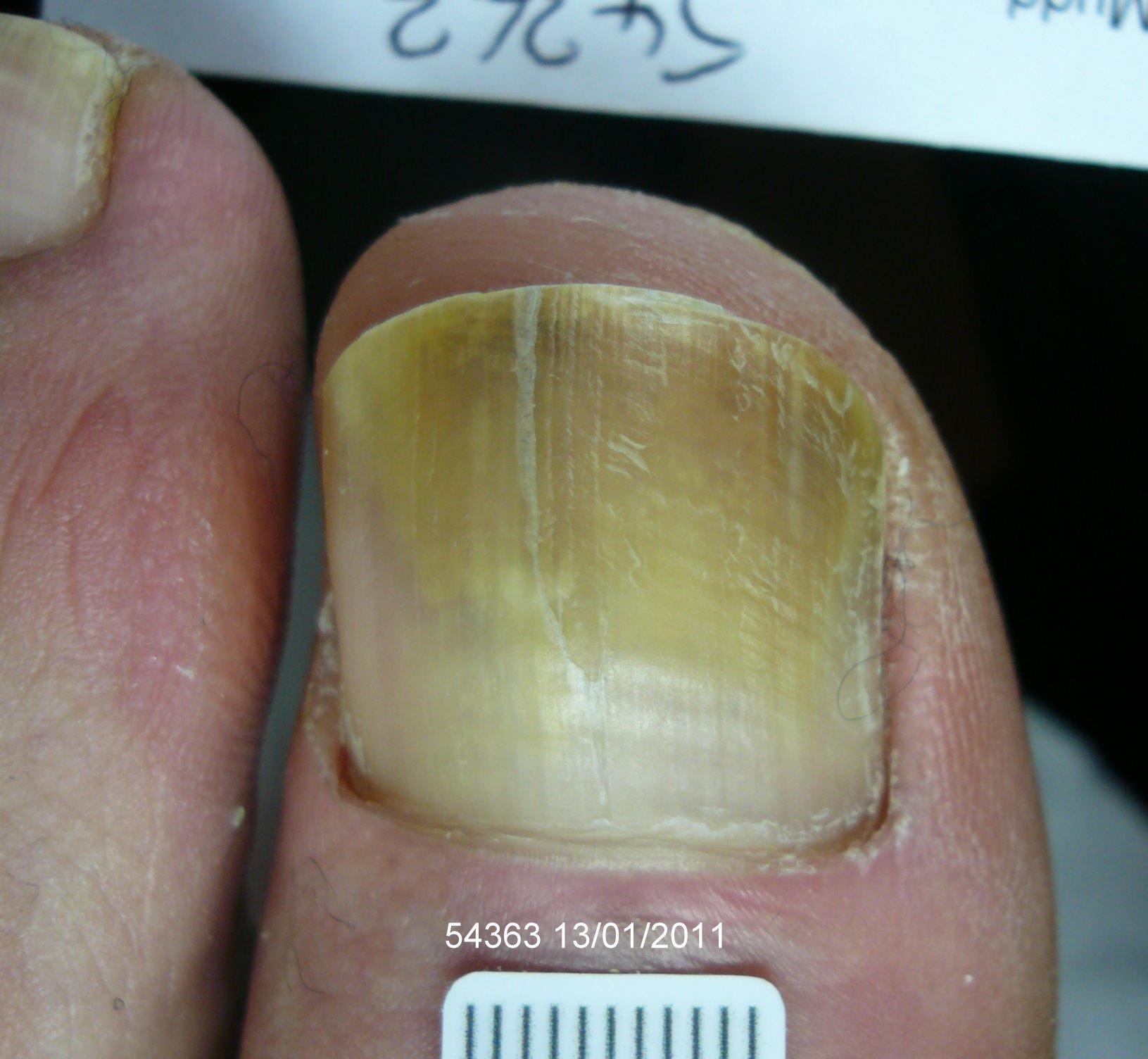 The London Nail Laser Clinic