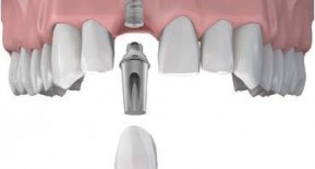 Cheshire Dental Solutions