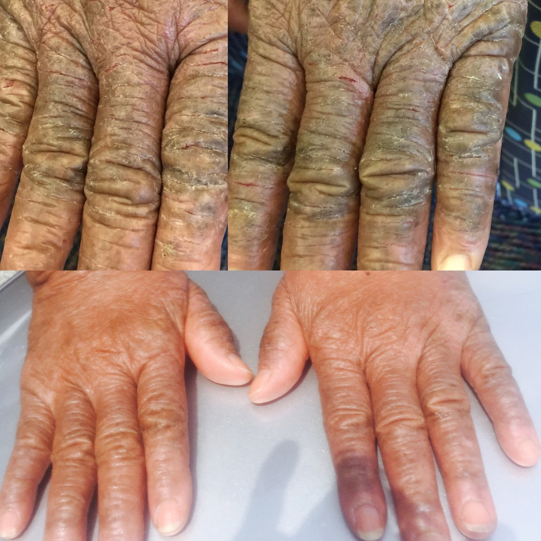 Glow Skin Enhancement