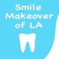 Smile Makeover of LA