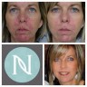 NERIUM INTERNATIONAL BRAND PARTNER