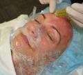 Newin Hair Transplant