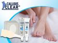 Callous Clear