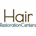 Affordable Hair Transplants Los Angeles
