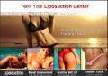 New York Liposuction Center