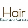 Affordable Hair Transplants Minneapolis