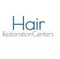 Affordable Hair Transplants San Francisco