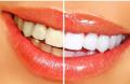 Cosmetic Dentist Greenville