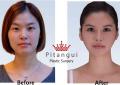 Pitangui Medical & beauty Center