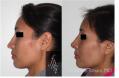 Facial Plastic Surgery Institute