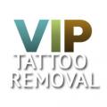 VIP Tattoo Removal - Las Vegas