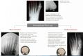 metatarsal rotation