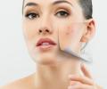 Lasting Beauty-Laser & Electrolysis
