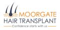 Moorgate Hair Transplant