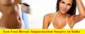 Breast augmentation in India Consult Cosmetic and Obesity Surgery Hospital India