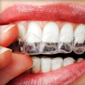 OrthodonTEX