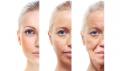 Anti Aging Skin Care Treatment