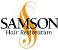 Samson Hair Restoration