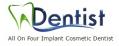 All On Four Dental Implants of Long Island