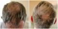 Tango Hair Loss Clinic