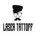 Laser Tattoff
