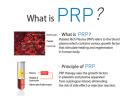 PRP Injection MD