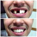 Grishin Denture Specialist