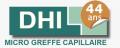 Greffe Cheveux a Bruxelles Hair Restoration Bruxelles Implant Capillaire Bruxelles