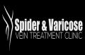 Spider & Varicose Vein Treatment Clinic