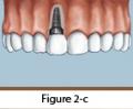 Watermanomfs - Dental Implant Provider Fairfield CA