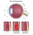 Vision and Eye Medical