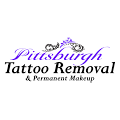 Pittsburgh Tattoo Removal