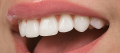 Cupertino Family & Cosmetic Dentistry