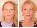 Perfection Plastic Surgery & Skin Care: Peter P Kay M.D.