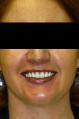 Elegant Smile Dental