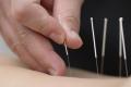Peoria Chiropractor & Acupuncture
