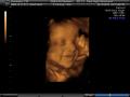 Clear Sight Ultrasound