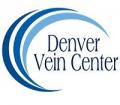 Denver Vein Center