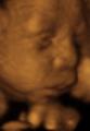 Love at First Sight 3D and 4D Ultrasound at Union Ultrasound, LLC
