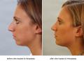 Robinson Facial Plastic Surgery