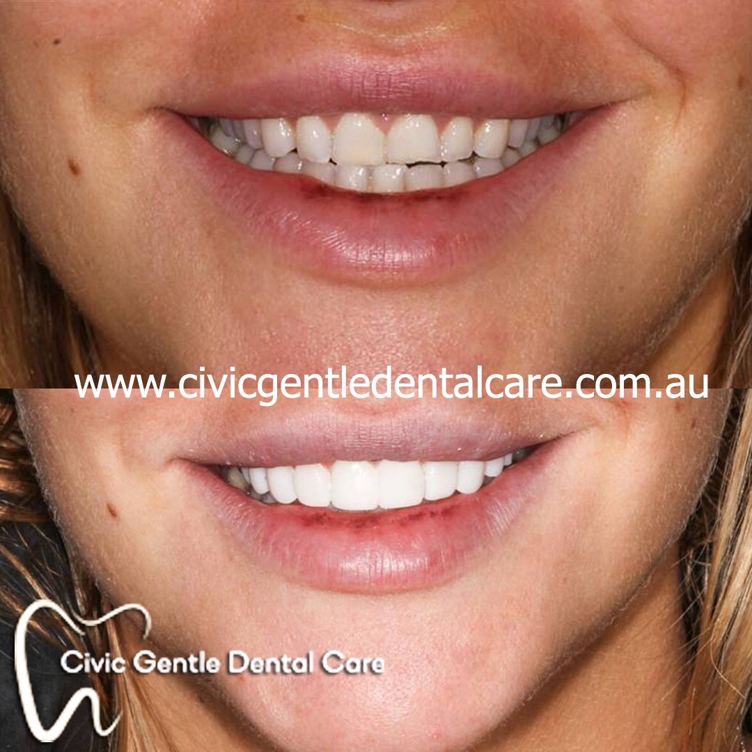 Civic Gentle Dental Care