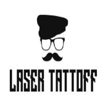 Laser Tattoff