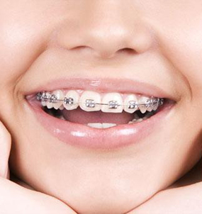 Dental Lounge Dubai, Satwa