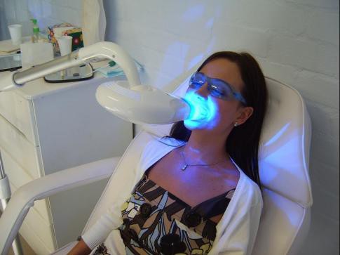 Laser Teeth Whitening Warwick