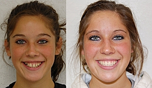 Smiles For Siouxland