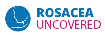 Rosacea Uncovered