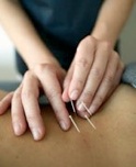 Acupuncture et Osteopathic